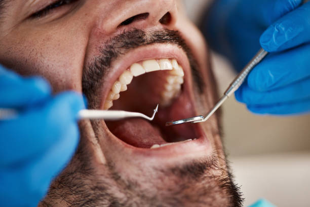 Best TMJ/TMD Treatment  in Napavine, WA